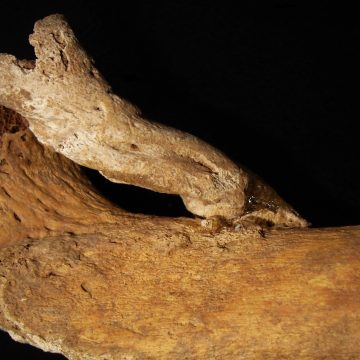 Centuries-old skeleton with massive, crippling bone growth unearthed in Portugal