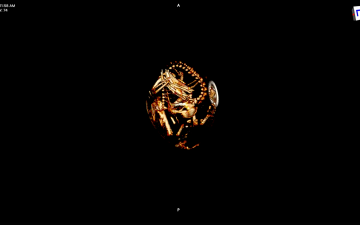 CT scans look inside a California condor egg