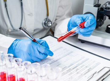 Scientists may have found a way to make a universal donor blood