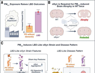 lewy-body-dementia-promotion-by-air-pollutants-science.jpg Lewy body dementia promotion by air pollutants | Science