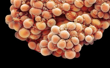 This little-known type of fat may actually protect your heart